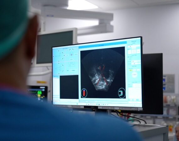 Prostate FUS image
