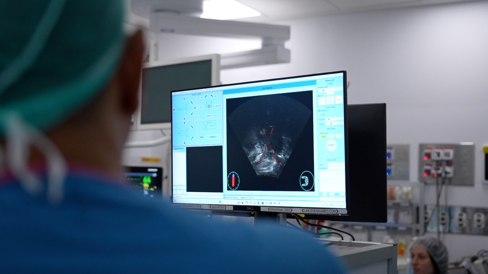Rambam Pilots Innovative Israeli-Developed Nonsurgical Treatment for Enlarged Prostate