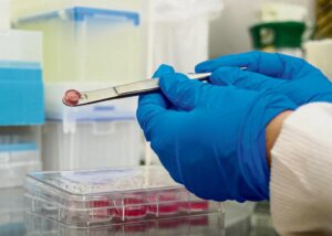 Sample tissue at MATRiC
