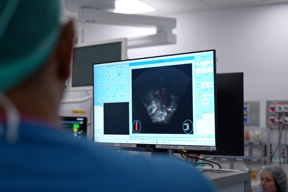 Prostate FUS image