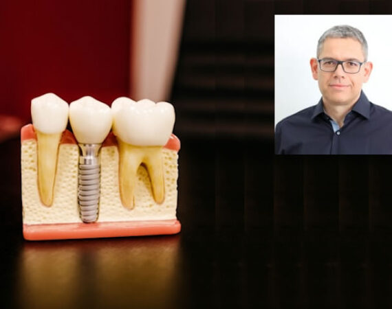 Smoking dental impact